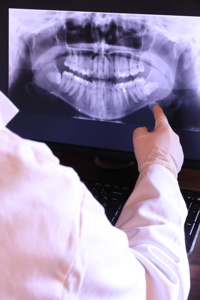 Best Emergency Treatment for Dental Infections or Abscesses in Portage, WI